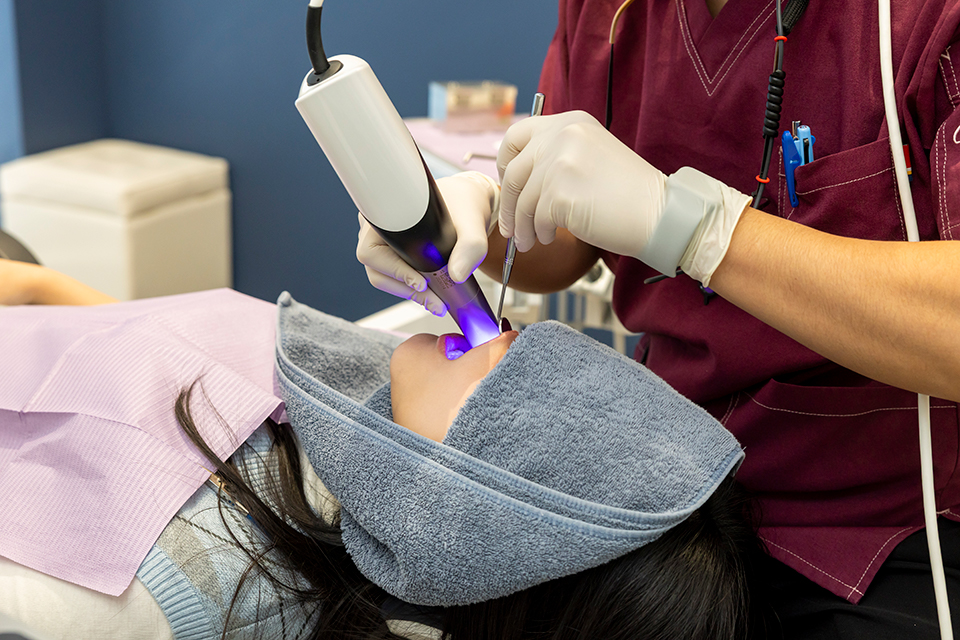 口腔内スキャナー