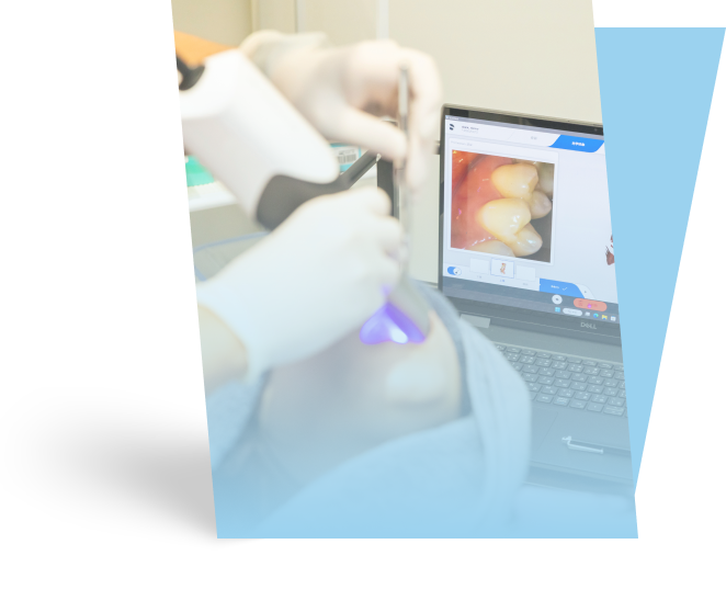 ホームホワイトニングは型取り不要